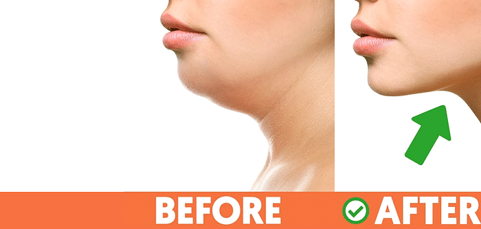 Exercise to reduce double chin online fast