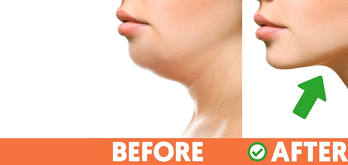Get Rid of Double Chin: Proven Exercises and Diet Tips